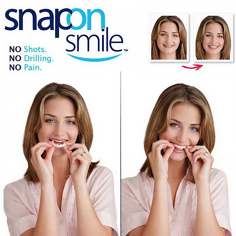 لمینت دندان دو فک مدل Snap on Smile